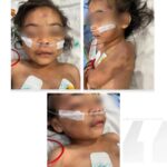 Miris! Balita di Kabupaten Bekasi Diduga Jadi Korban Penganiayaan Ibu Tiri